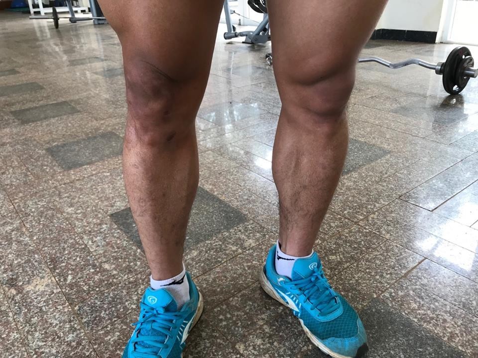 Vũ Văn Thanh xác định thời gian trở lại sân cỏ - Bóng Đá