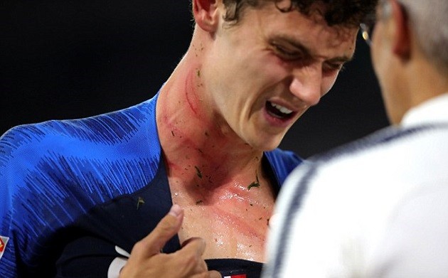 NÓNG: Pavard suýt mất mạng vì hành động này của Rudiger - Bóng Đá