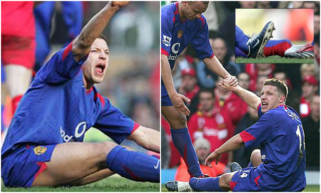 Những tình huống gãy chân kinh hoàng: Niềm đau cho Arsenal và Man Utd! - Bóng Đá