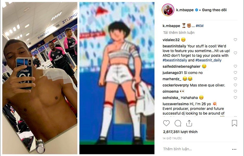 Chấn thương vai, Kylian Mbappe có hành động ví von cực chất - Bóng Đá