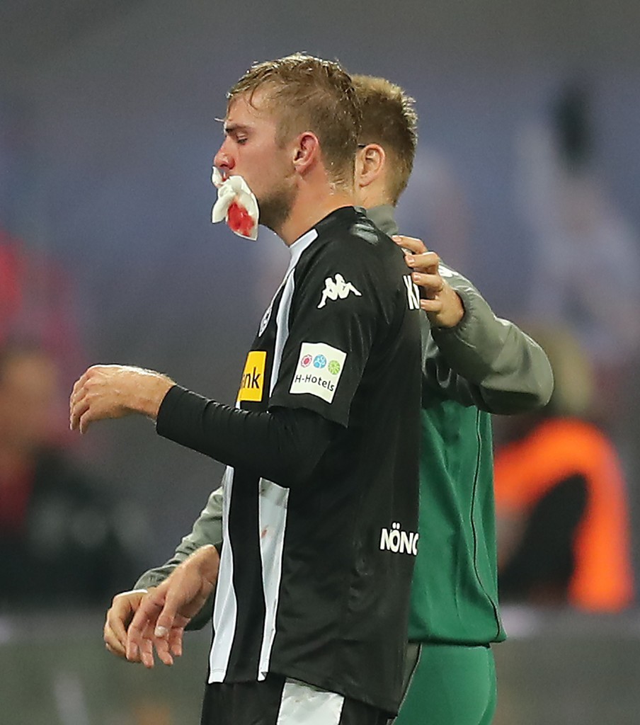 RB Leipzig 2-2 Monchengladbach: Rượt đuổi gay cấn, Naby Keita lĩnh thẻ đỏ - Bóng Đá
