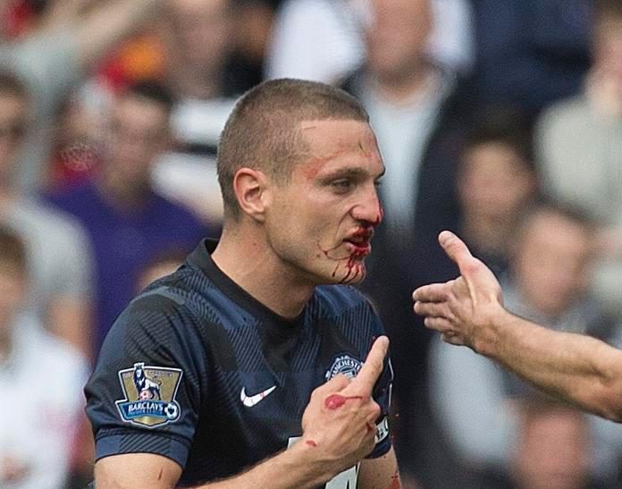 Vidic TIẾT LỘ đối thủ xấu chơi nhất Ngoại hạng Anh - Bóng Đá