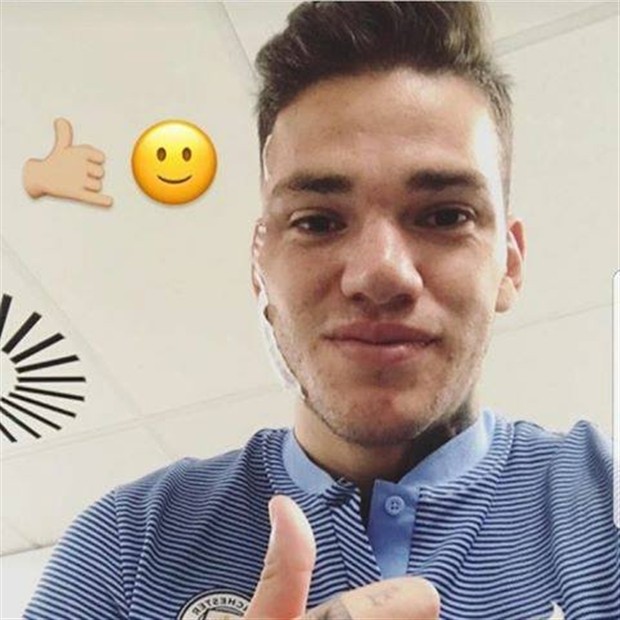 Ederson tự tin khoe thẹo sau cú vào bóng của Mane - Bóng Đá