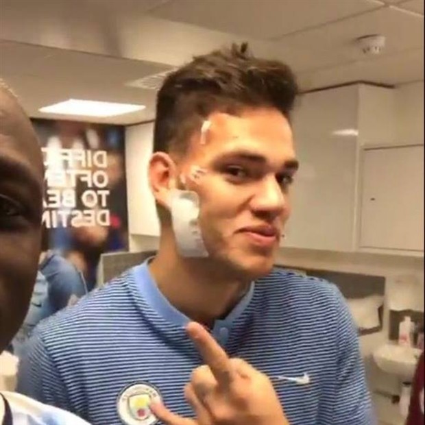 Ederson tự tin khoe thẹo sau cú vào bóng của Mane - Bóng Đá