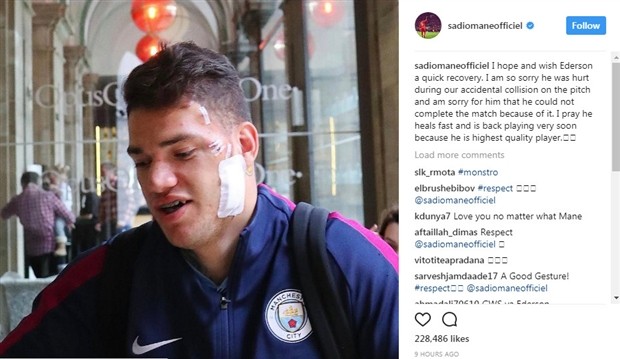 Ederson tự tin khoe thẹo sau cú vào bóng của Mane - Bóng Đá