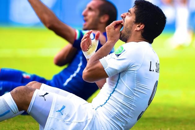 Thất kinh với 20 khoảnh khắc gây sốc tại các kỳ World Cup (Phần 1) - Bóng Đá
