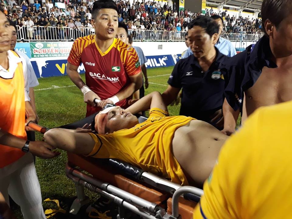 Vòng 11 V-League 2018: HAGL và SLNA tổn thất nặng về lực lượng - Bóng Đá