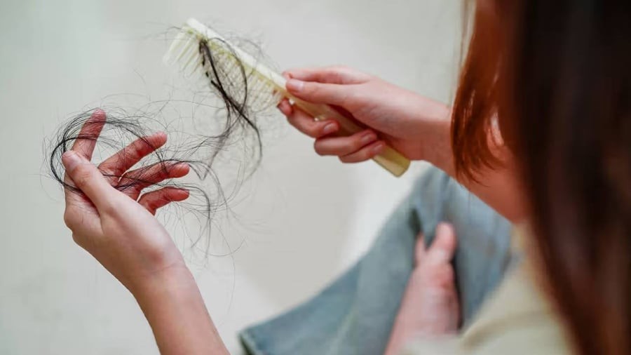 Đường và các món ăn chứa nhiều đường có thể làm tóc rụng nhiều hơn.