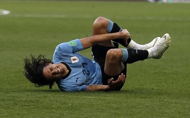 Edinson Cavani sẽ 'phá hủy y học' để tử chiến với Pháp - Bóng Đá