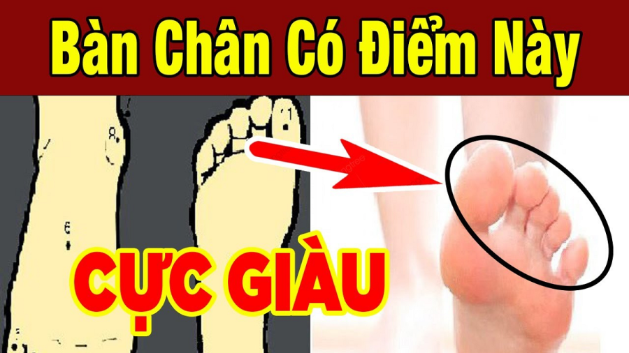 Tướng bàn chân may mắn
