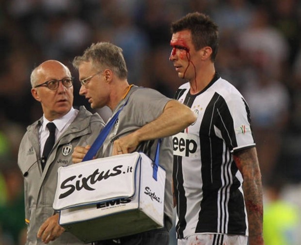 Chấm điểm đội hình Juventus vs Lazio: Alves 'cân' cả thế giới - Bóng Đá
