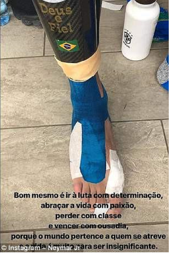 Neymar bảo vệ bàn chân bạc tỷ như thế nào? - Bóng Đá