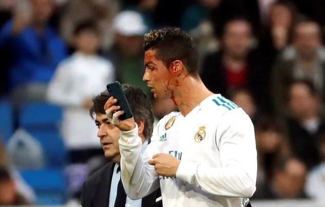 Cực hài: Ronaldo mượn điện thoại bác sĩ soi vết thương - Bóng Đá