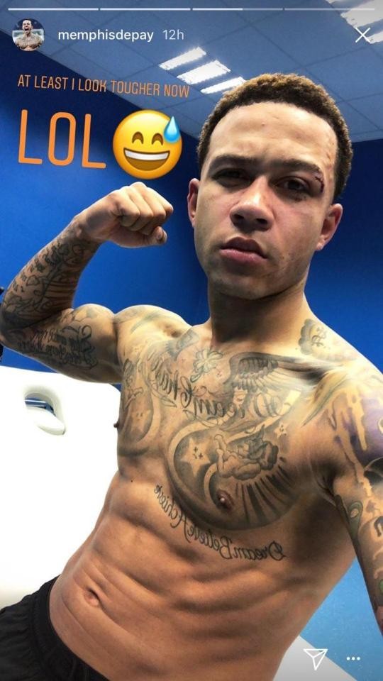 Đã rõ tình hình sức khỏe của Memphis Depay - Bóng Đá