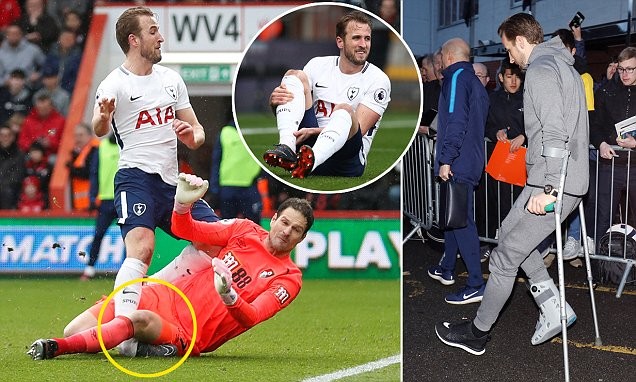Điểm tin sáng 12/03: Cech đạt cột mốc vĩ đại, Kane có thể lỡ World Cup - Bóng Đá