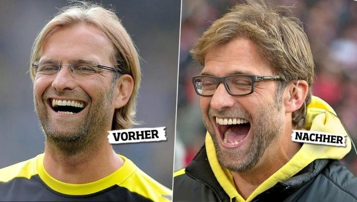 10-bi-mat-ve-jurgen-klopp