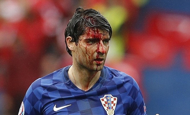 Máu đã đổ trên đầu hậu vệ Corluka của Croatia sau một pha va chạm. Ảnh: Internet.