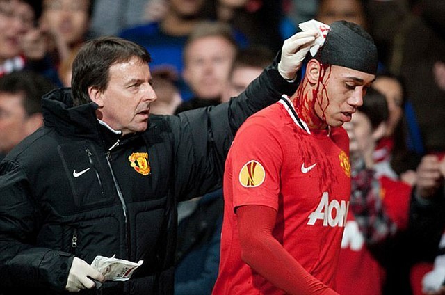 MU-Smalling-2