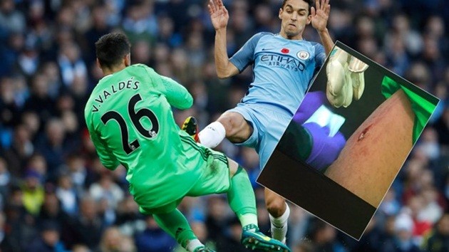 valdes-1