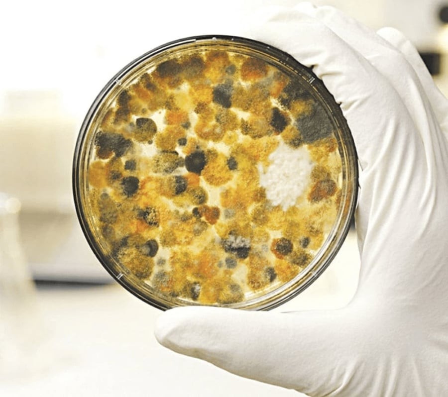Một trong những yếu tố nguy cơ được nhắc đến là Aflatoxin – độc tố vi nấm thường xuất hiện trong thực phẩm bị mốc, do một số loài nấm thuộc nhóm Aspergillus sinh ra.
