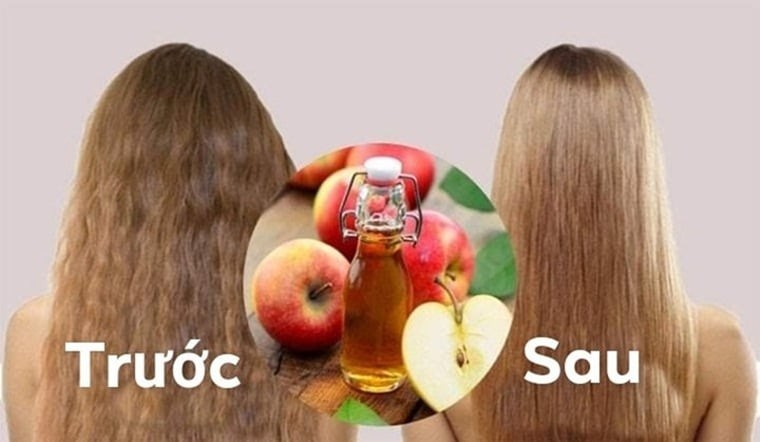 Không chỉ được sử dụng trong nấu ăn, giấm táo còn được nhiều người dùng để chăm sóc tóc nhờ khả năng làm sạch nhẹ nhàng.
