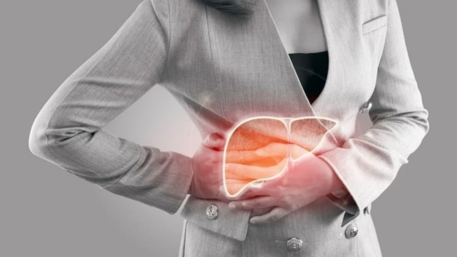 Khi chức năng gan bị suy yếu, người bệnh có thể có các dấu hiệu như vàng da, vàng mắt, nước tiểu thay đổi màu sắc.