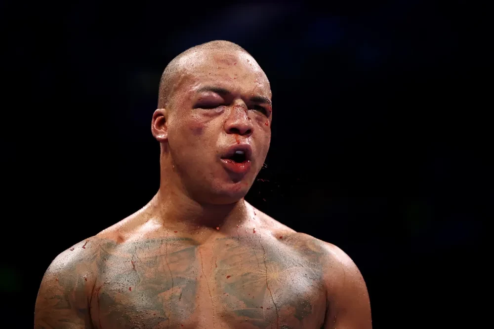 Khuôn mặt thất thần của Fabio Wardley trong trận đấu với Daniel Dubois