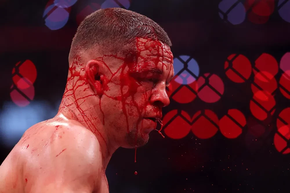 Nate Diaz thi đấu với Mike Perry