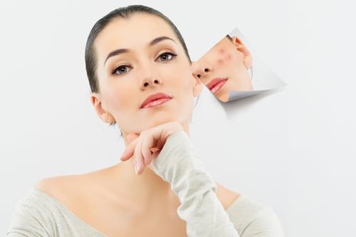 Sau khi vận động nhiều hoặc đổ mồ hôi, nên thay quần áo sớm để giữ da thông thoáng hơn.