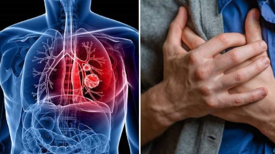 Đau tức ngực kéo dài cũng là một dấu hiệu cảnh báo ung thư phổi.