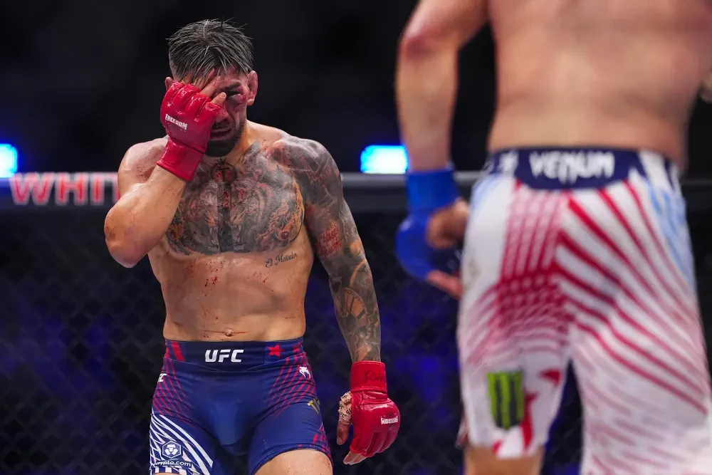 Ilia Topuria kiểm tra vết thương trong trận đấu với Justin Gaethje tại UFC White House