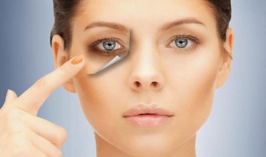  Điều này khiến da trở nên nhợt nhạt, làm các mạch máu dưới da hiện rõ hơn và tạo cảm giác vùng mắt sẫm màu.