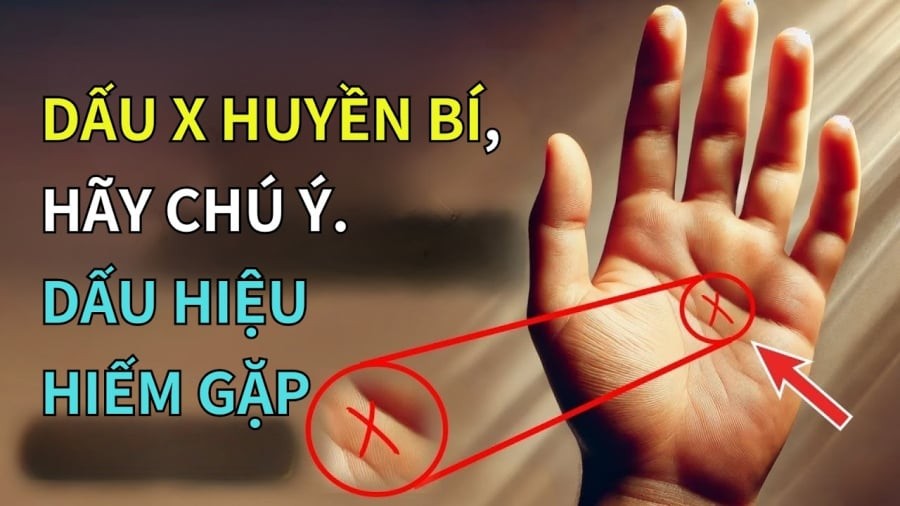 Dấu hiệu này sẽ sống thọ 