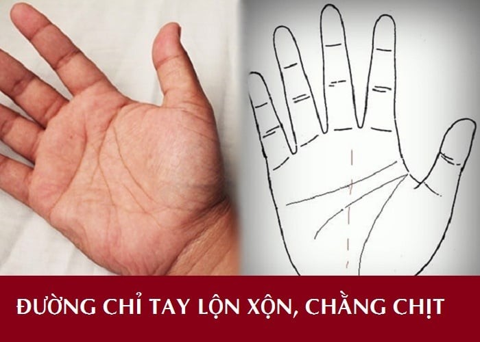tay ngheo