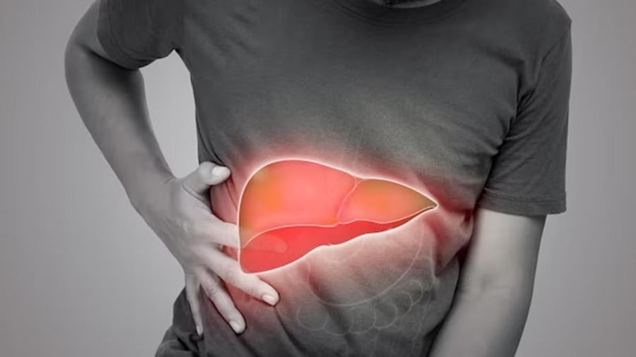 Dấu hiệu cảnh báo bệnh gan đã đi vào giai đoạn nặng 