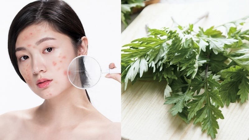 Ngải cứu tươi sau khi được rửa sạch có thể xay hoặc giã nhuyễn để tạo thành hỗn hợp đắp mặt.


