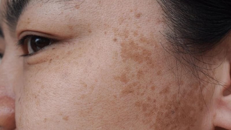 Nhiều người đã hình thành thói quen sử dụng kem chống nắng mỗi sáng nhưng lại chỉ dùng một lượng rất nhỏ vì lo da nhờn hoặc bí bách.