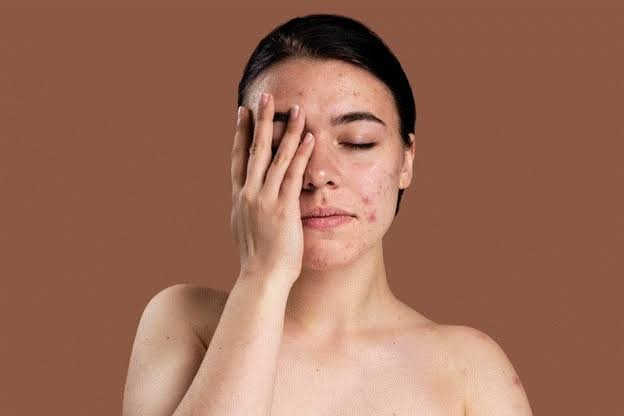 Những sản phẩm kết hợp nhiều hoạt chất bổ trợ thường mang lại hiệu quả toàn diện hơn so với các công thức chỉ tập trung vào một thành phần duy nhất.

