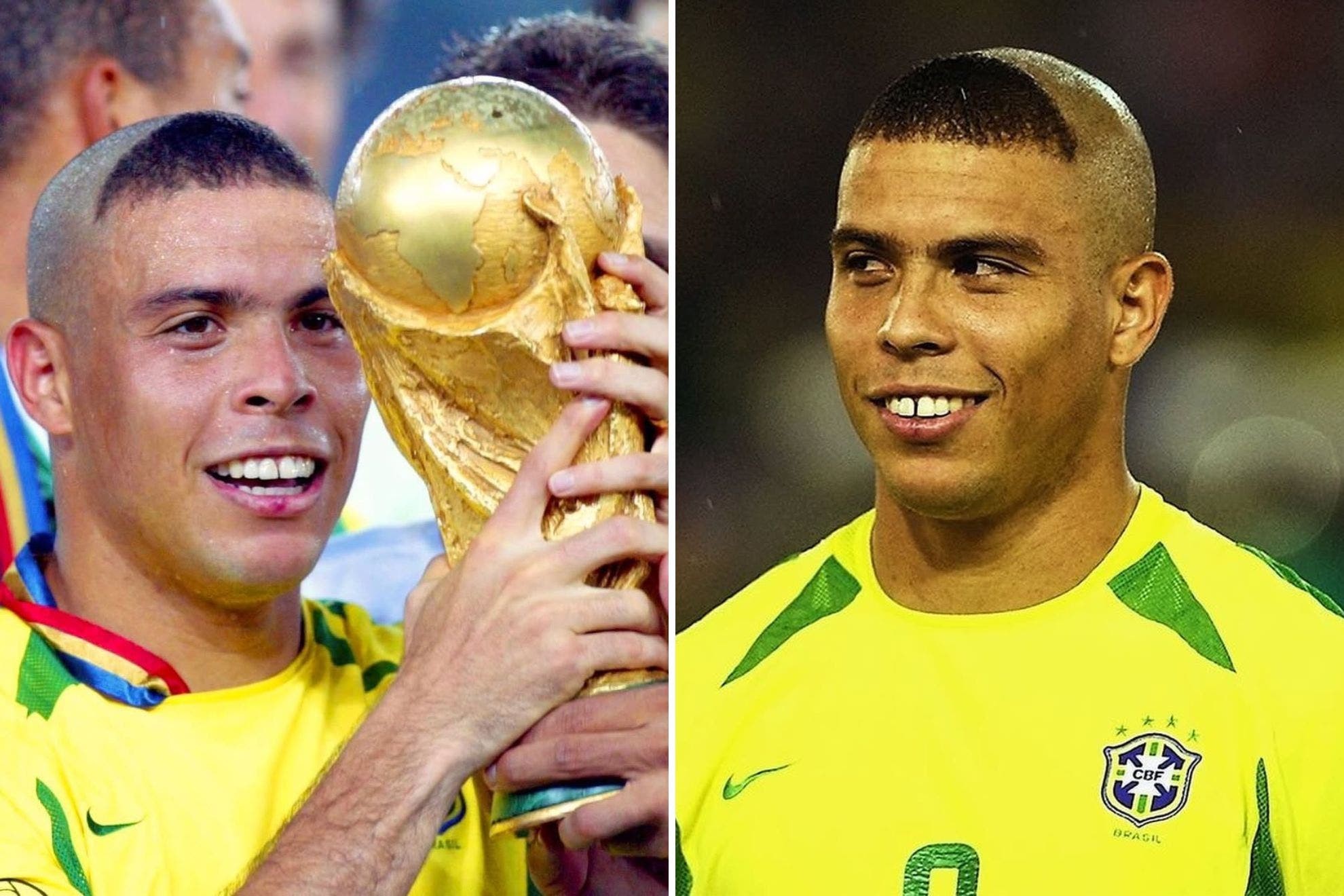Diện mạo kỳ quặc giúp Ronaldo giải tỏa áp lực chấn thương. Ảnh: Bein sports.
