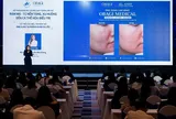 Sự trở lại của dòng sản phẩm Nu-Derm® FX cải tiến: Giải pháp chăm sóc toàn diện và an toàn cho tình trạng rám má
