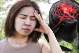 Chóng mặt tưởng bị rối loạn tiền đình, sau 3 ngày người phụ nữ bất ngờ khi biết bị nhồi máu não