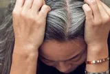 Tóc bạc sớm không chỉ do tuổi tác: Những nguyên nhân ít ngờ và cách chăm sóc để tóc khỏe hơn