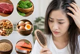 Rụng tóc nhiều là đnag thiếu chất gì?