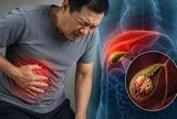 3 dấu hiệu cảnh báo viêm túi mật nặng