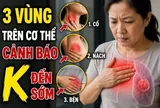3 vùng trên cơ thể cảnh báo K đến sớm