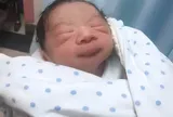 Tiểu công chúa chào đời kèm 1 bào thai nữa dính chặt vào mông, bác sĩ cũng ngỡ ngàng: Cực hiếm gặp!