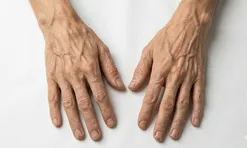 5 dấu hiệu cảnh báo sớm ung thư gan