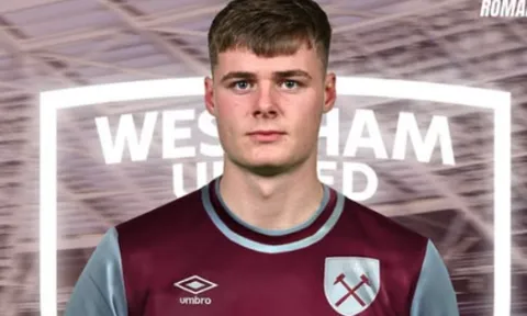NÓNG! Ferguson tái hợp Potter