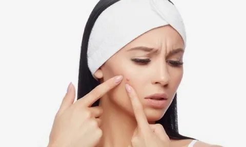 5 bước "cấp cứu" làn da sau những đêm thức khuya
