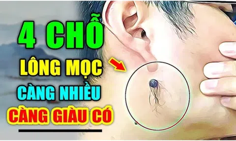 Lông mọc chỗ này điềm báo phát tài: Ngồi không cũng giàu, ai có thật đáng chúc mừng